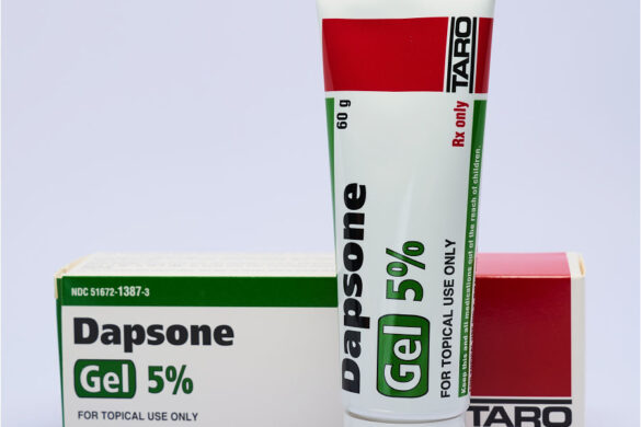 What Is Dapsone Gel?